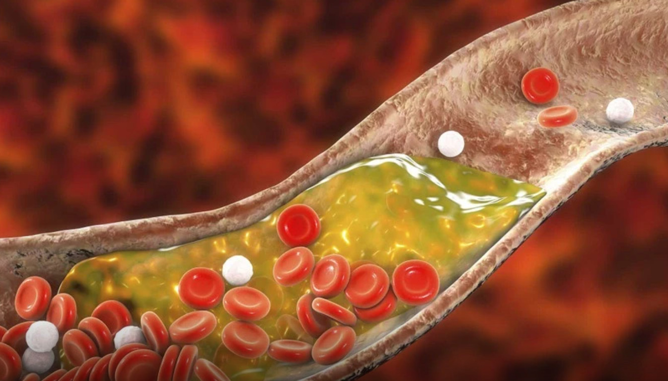 Uống cà phê hỗ trợ làm giảm mỡ máu, tốt cho người mỡ máu cao nhưng tác dụng giảm mỡ máu của cà phê tùy trường hợp. Ảnh: Freepik.