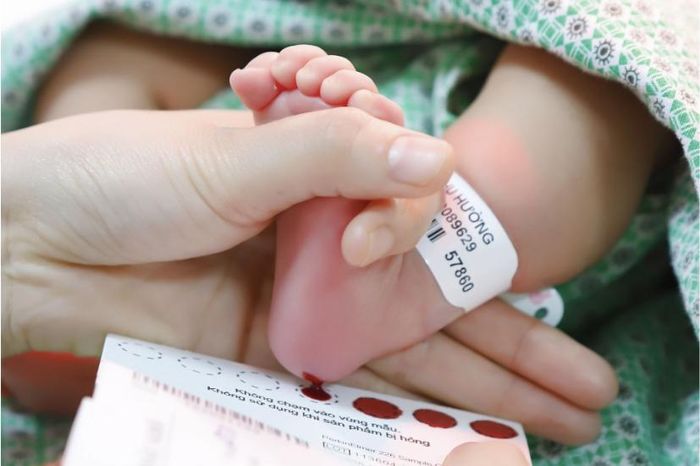 Lấy mẫu máu gót chân trẻ sơ sinh để sàng lọc phát hiện dị tật bẩm sinh.