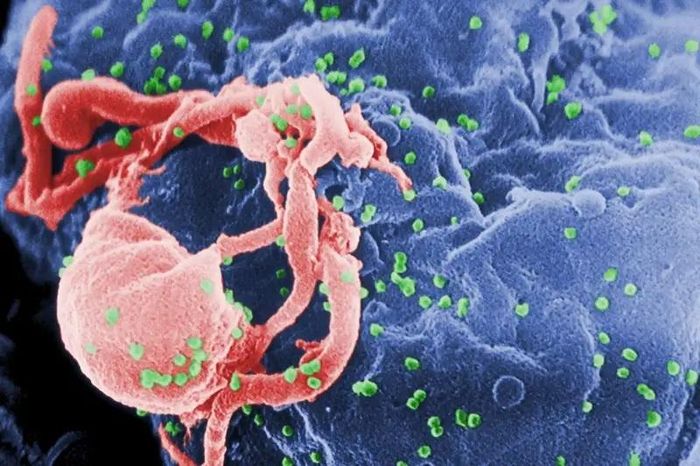 Hình ảnh về quá trình virus HIV (màu xanh lá cây) lây nhiễm một tế bào miễn dịch. Ảnh: CDC/New Scientist.