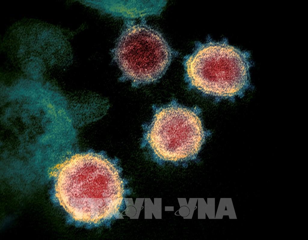 Hình ảnh từ kính hiển vi do Viện Y tế quốc gia Mỹ cung cấp cho thấy virus SARS-CoV-2 trong mẫu bệnh phẩm của bệnh nhân mắc COVID-19 ở Mỹ. 