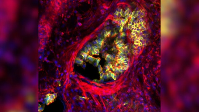 Hình ảnh kính hiển vi cho thấy các tế bào biểu mô đường thở bị ép ra ngoài trong quá trình mô phỏng hóa học của cơn hen suyễn.(Ảnh: Dustin Bagley và Tobias Russell, Kings College London)