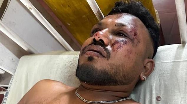 Nạn nhân sống sót sau vụ rơi máy bay, Vishwash Kumar Ramesh. Ảnh: Daily Mail