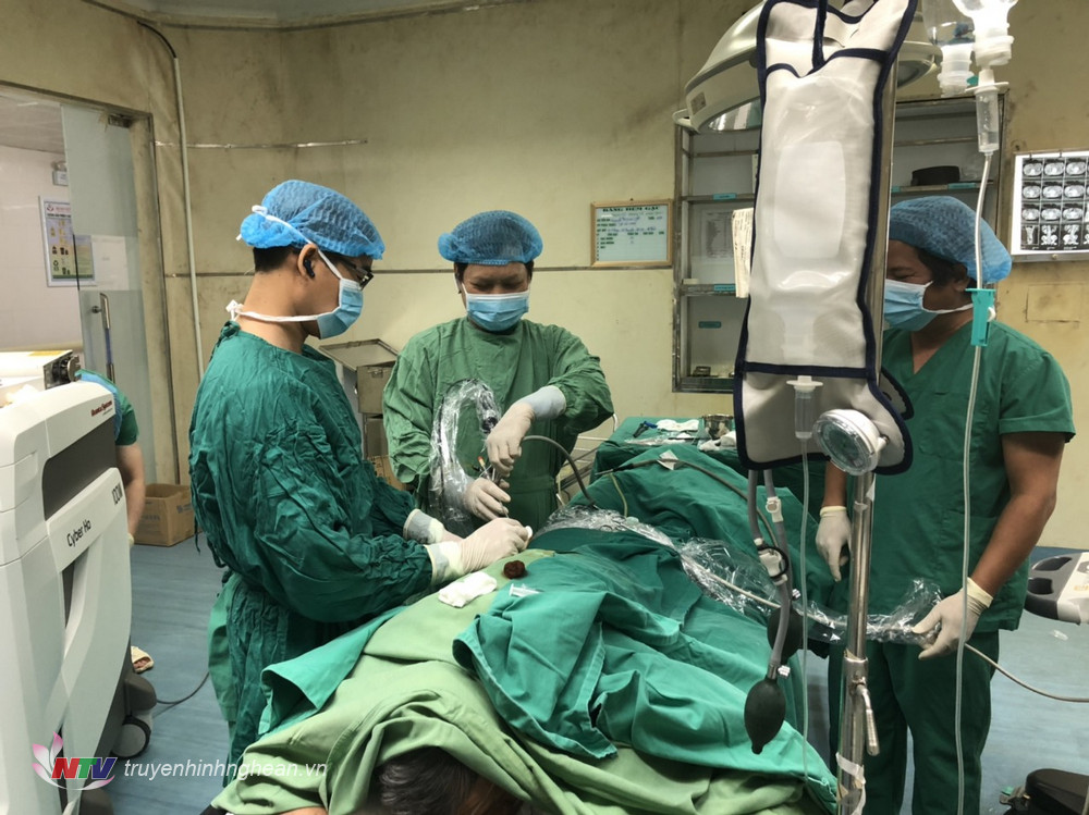 Đại tá, Bác sĩ Chuyên Khoa 2 Nguyễn Văn Hương - Chủ nhiệm Khoa B3 cùng kíp mổ đang tiến hành phẫu thuật tán sỏi thận qua da cho bệnh nhân Nguyễn Xuân Thủy.