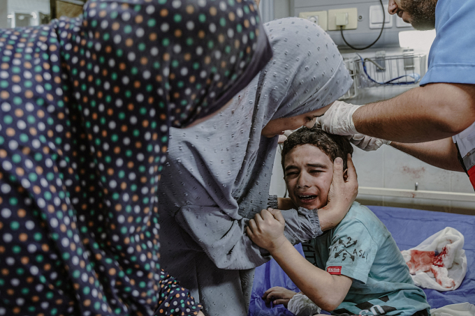 Cậu bé bị thương sau vụ ném bom của Israel ở Dải Gaza ngày 12/10. Ảnh: AFP