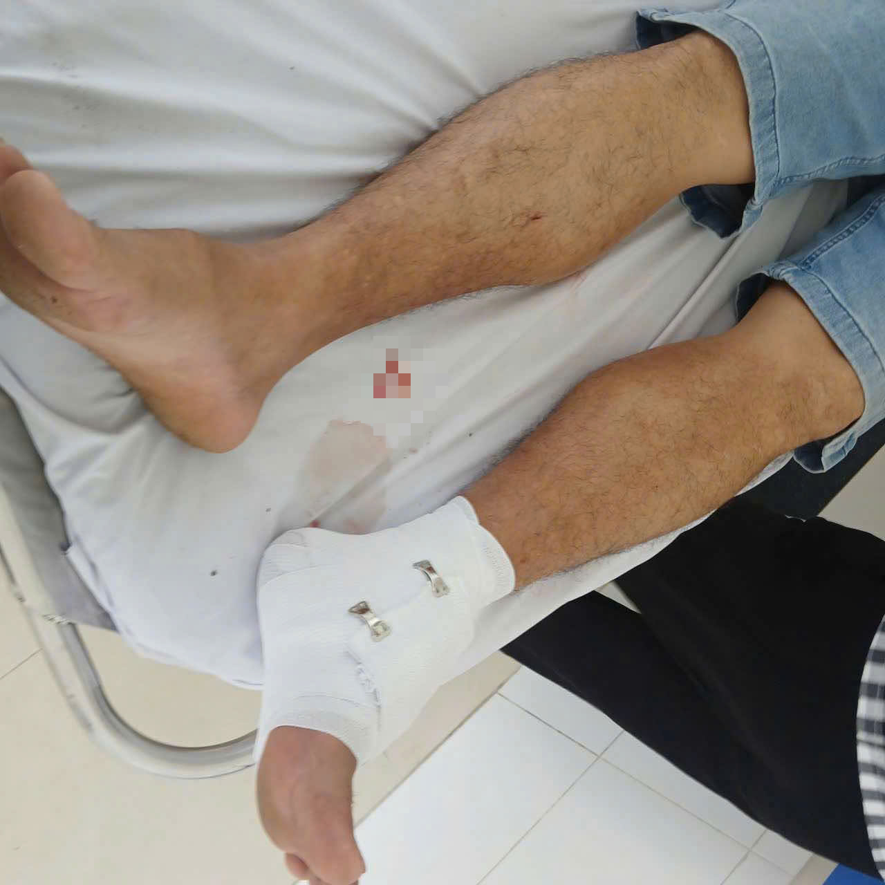 Con cá sấu sổng chuồng cắn chân một thầy giáo ở Tây Ninh