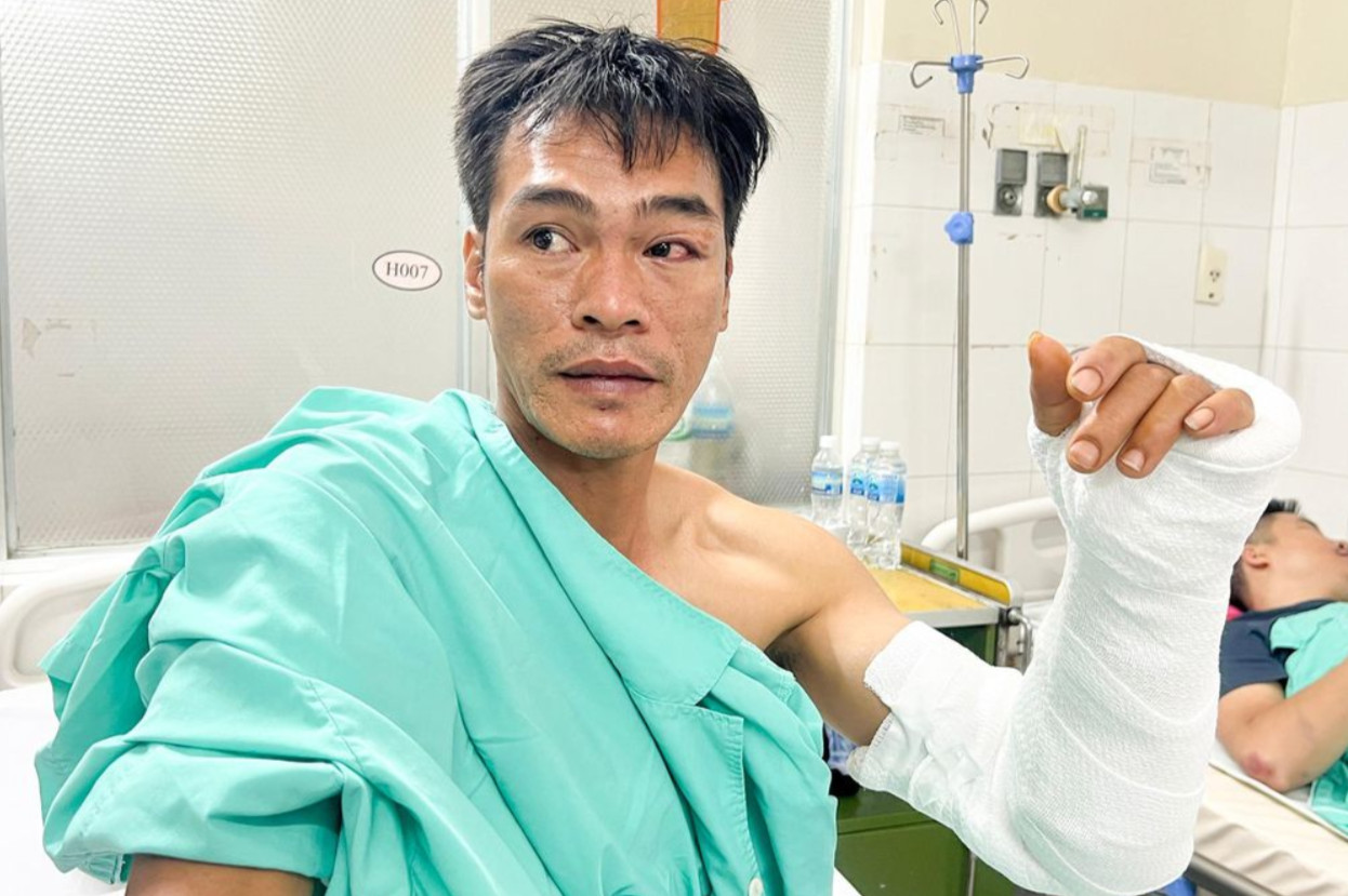 Phụ xe khách Nguyễn Long Cương kể lại giây phút ô tô gặp nạn. Ảnh: X.N