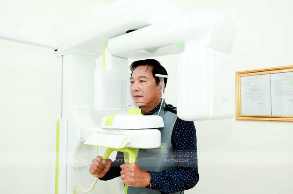Chụp phim CT ConeBeam để đảm bảo an toàn khi cấy ghép trụ Implant