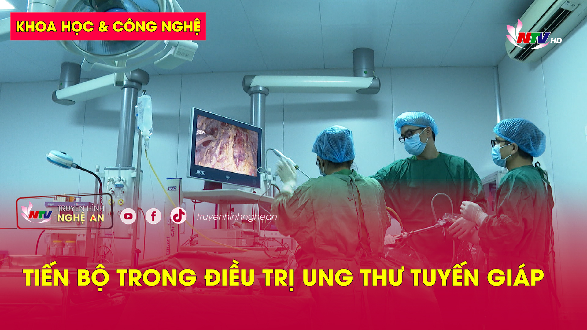 Khoa học & Công nghệ: Tiến bộ trong điều trị ung thư tuyến giáp