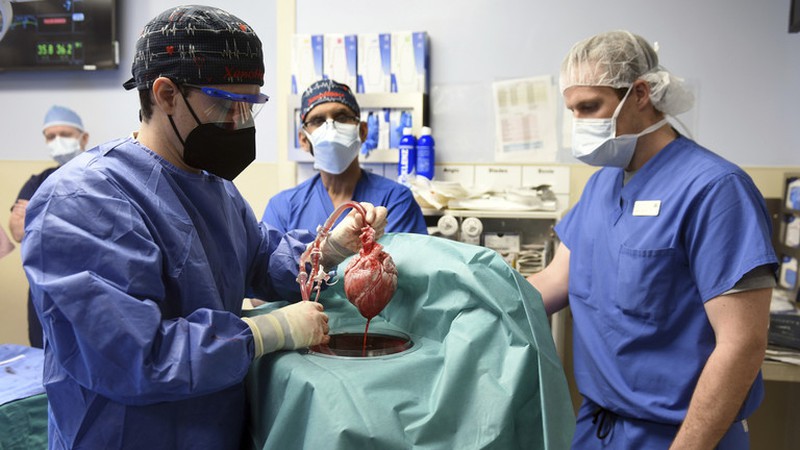 Các bác sĩ đang tiến hành ca phẫu thuật tại Trung tâm Y tế Đại học Maryland. Ảnh: RT