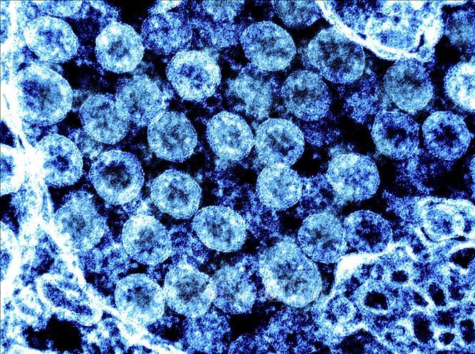 Hình ảnh quét qua kính hiển vi điện tử virus SARS-COV-2 lấy từ mẫu bệnh phẩm của bệnh nhân COVID-19 tại Viện Nghiên cứu Dị ứng và Bệnh Truyền nhiễm Quốc gia, Mỹ ngày 1/8/2021. Ảnh minh họa: AFP/TTXVN
