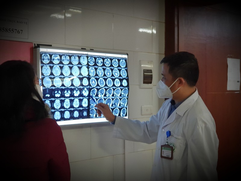 Bác sĩ Nguyễn Trung Nguyên mô tả dấu hiệu tổn thương não từ kết quả chụp cắt lớp não bệnh nhân bị ngộ độc khí CO.