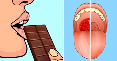 Ăn sô-cô-la đen để giảm đau họng: Theo các nhà khoa học, sô-cô-la đen có khả năng giảm ho và làm dịu cơn đau họng tốt hơn cả thuốc nhờ có thành phần cacao với hàm lượng lớn.
