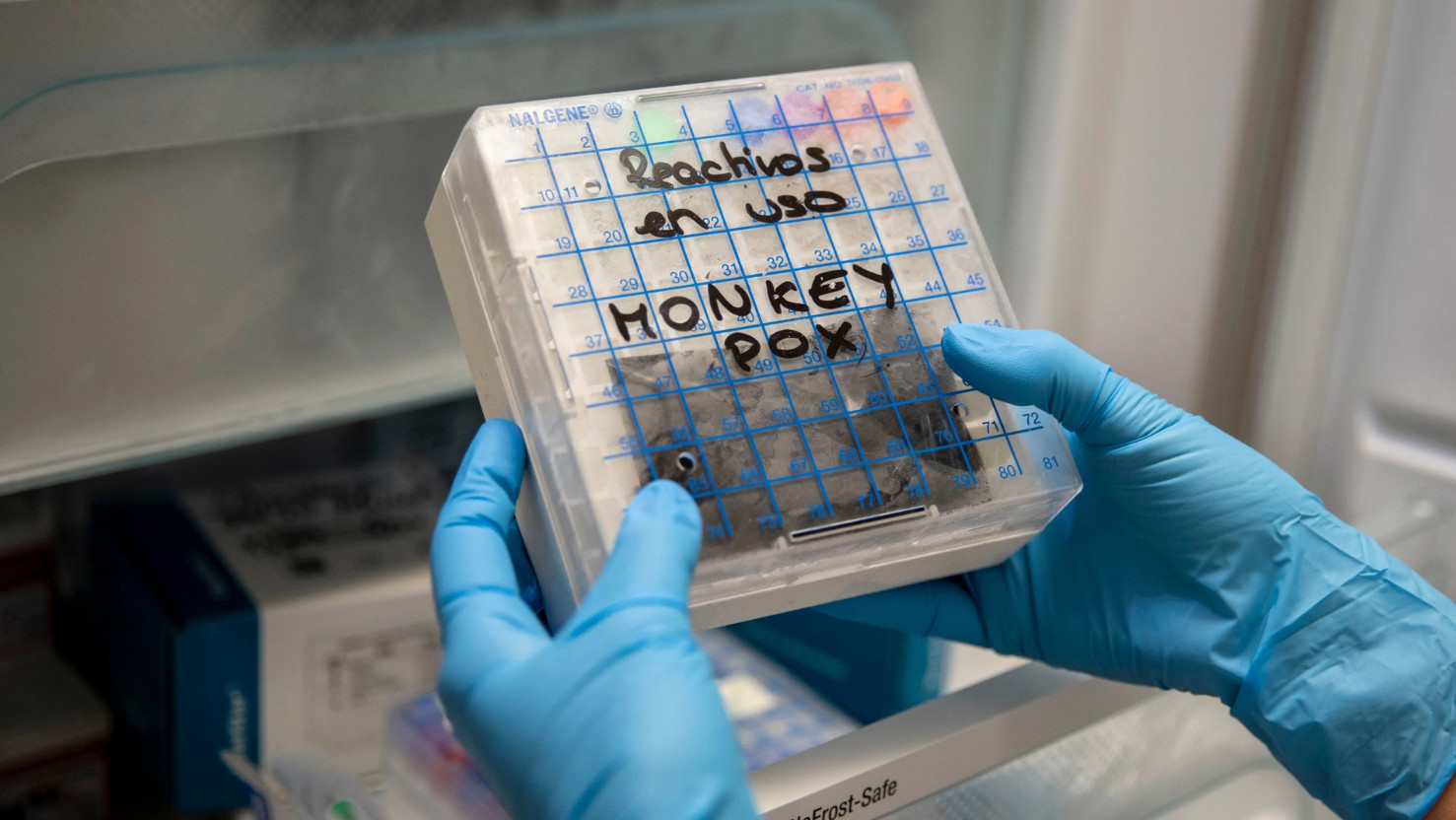 Các mẫu xét nghiệm đậu mùa khỉ tại Bệnh viện La Paz, Madrid, Tây Ban Nha. Ảnh: Pablo Blazquez Dominguez.