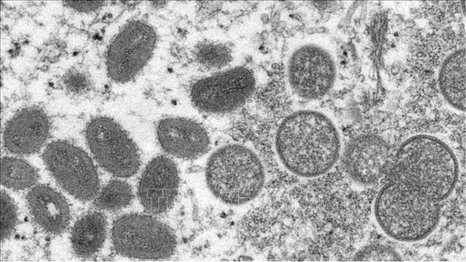 Hình ảnh dưới kính hiển vi do Trung tâm kiểm soát và phòng ngừa dịch bệnh công bố về virus đậu mùa khỉ. 