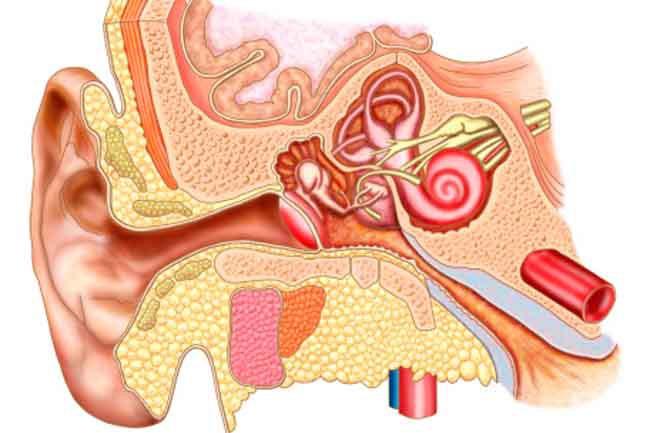 Viêm tai Cholesteatoma: Cholesteatoma là sự phát triển bất thường của của phần da ở tai giữa từ phần màng nhĩ bị rách hoặc do sự phát triển trong da xuyên qua lỗ thủng màng nhĩ. Ban đầu, chúng thường rất nhỏ, nhưng khi cholesteatoma phát triển, chúng có thể phá hủy xương tai giữa, gây mất thính giác.