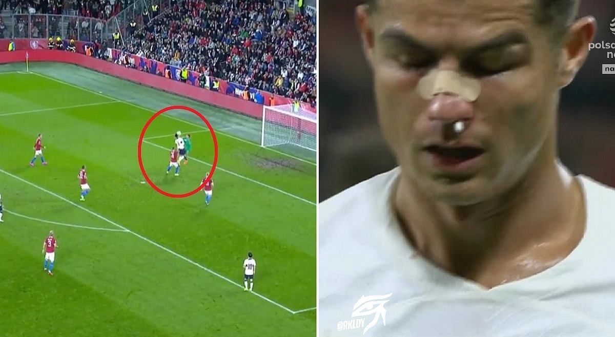 Ronaldo sớm dính chấn thương trong trận gặp CH Czech. (Ảnh: The Sun)