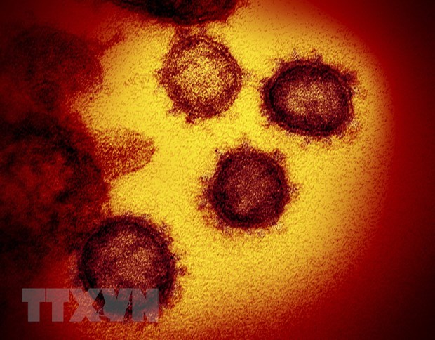 Hình ảnh dưới kính hiển vi từ viện y tế quốc gia Mỹ cung cấp cho thấy virus SARS-CoV-2 gây bệnh COVID-19 được phân lập và xuất hiện trên bề mặt tế bào của một bệnh nhân ở Mỹ. 