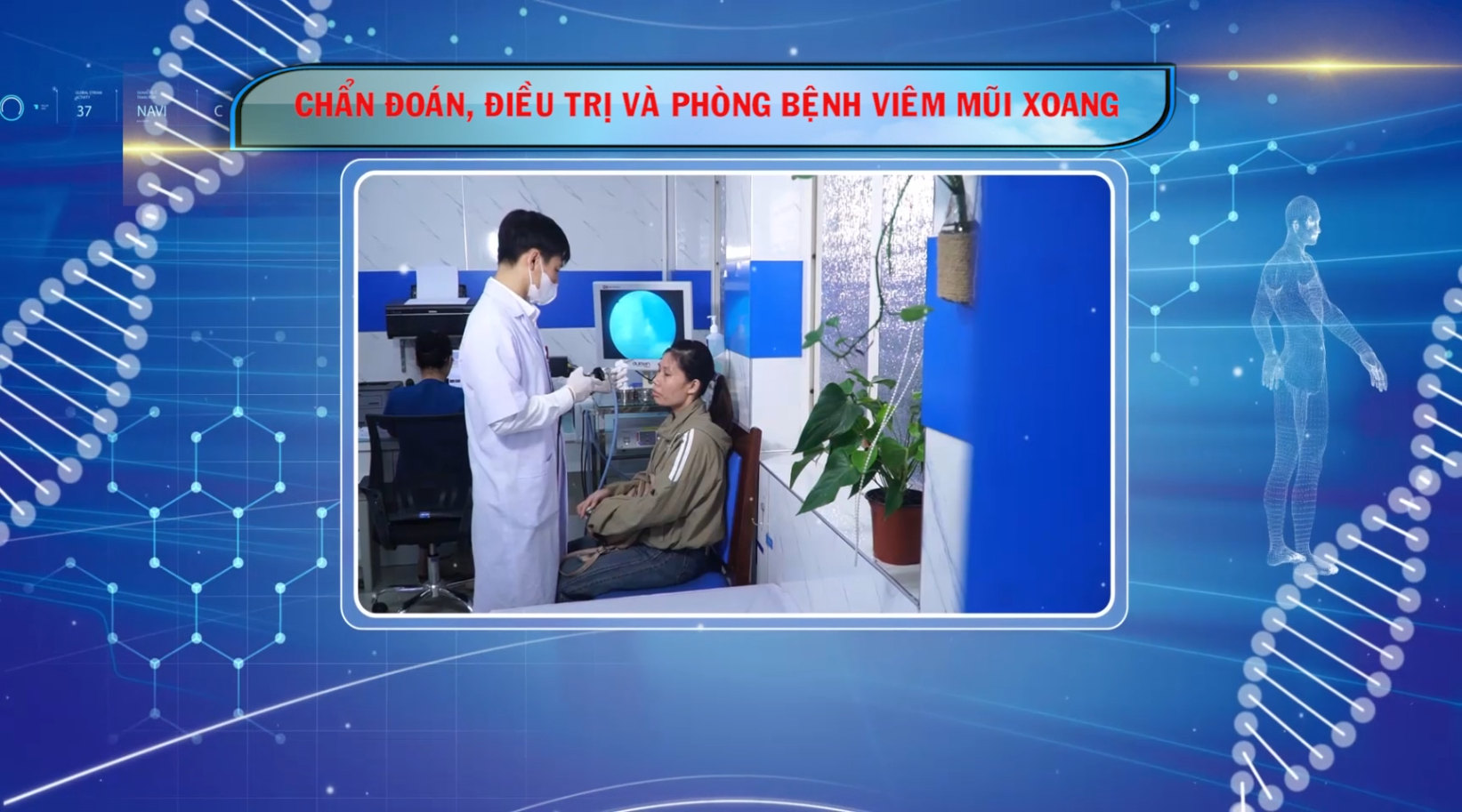 [🔴Trực tiếp] Sức khỏe của bạn: Chẩn đoán, điều trị và phòng bệnh viêm mũi xoang